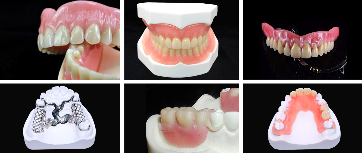 Removable Denture(图1)